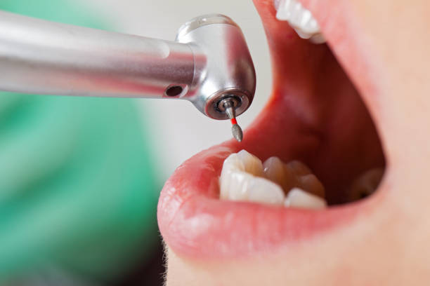 Best Orthodontic Emergency Dentist in Tarkio, MO